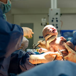 Neonatal Surgeries